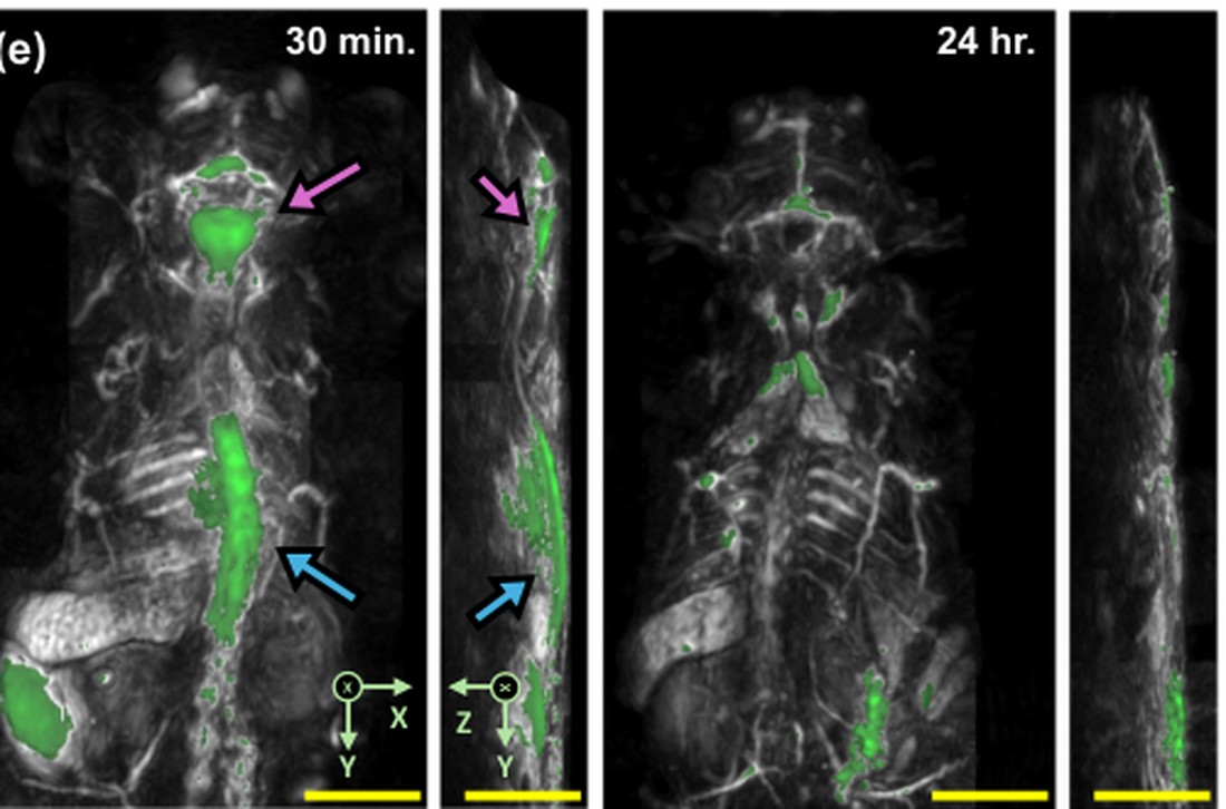 Photoacoustic monitoring of cerebrospinal fluid dynamics